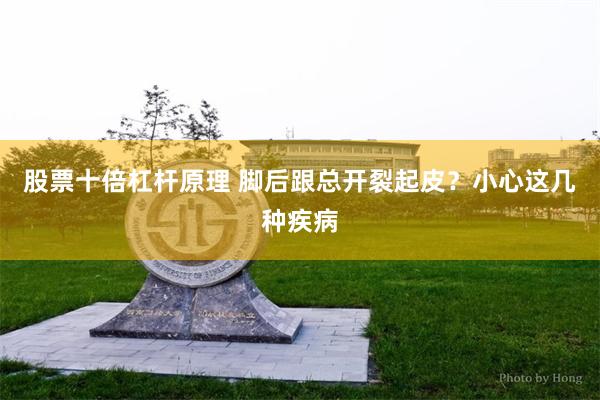 股票十倍杠杆原理 脚后跟总开裂起皮？小心这几种疾病
